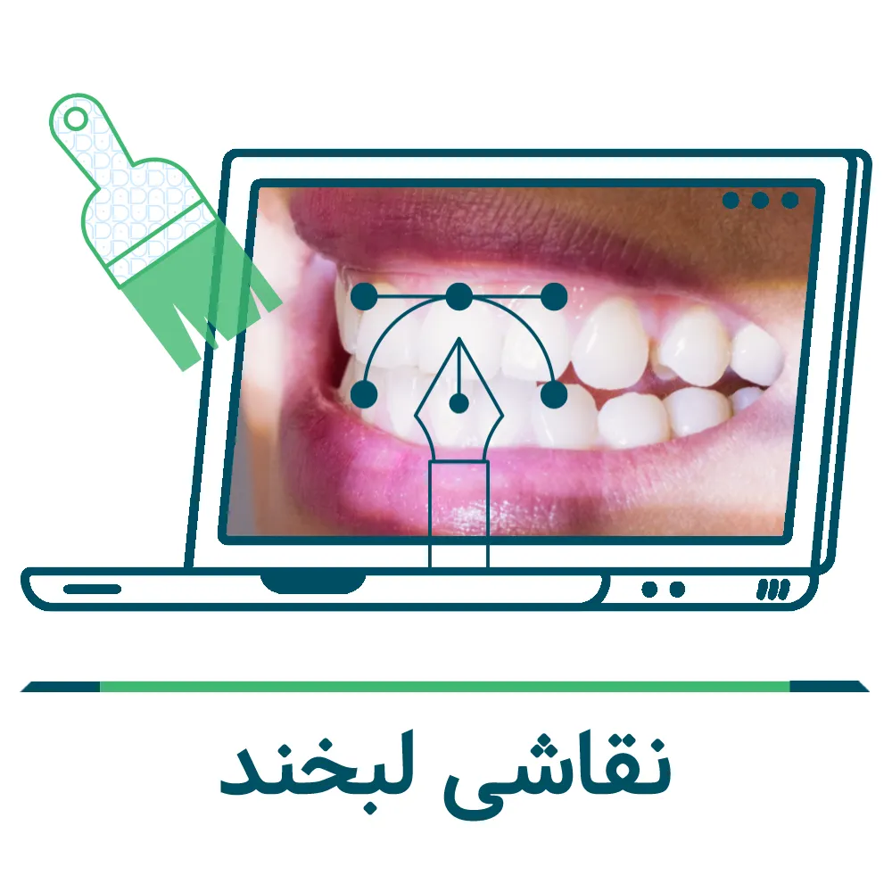 کامپوزیت دندان