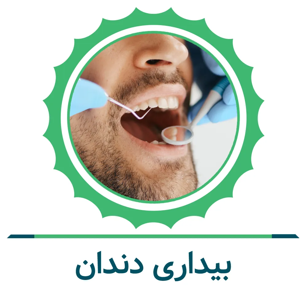 جرم‌گیری دندان