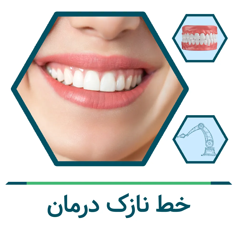 laser-gum-surgery جراحی لثه با لیزر