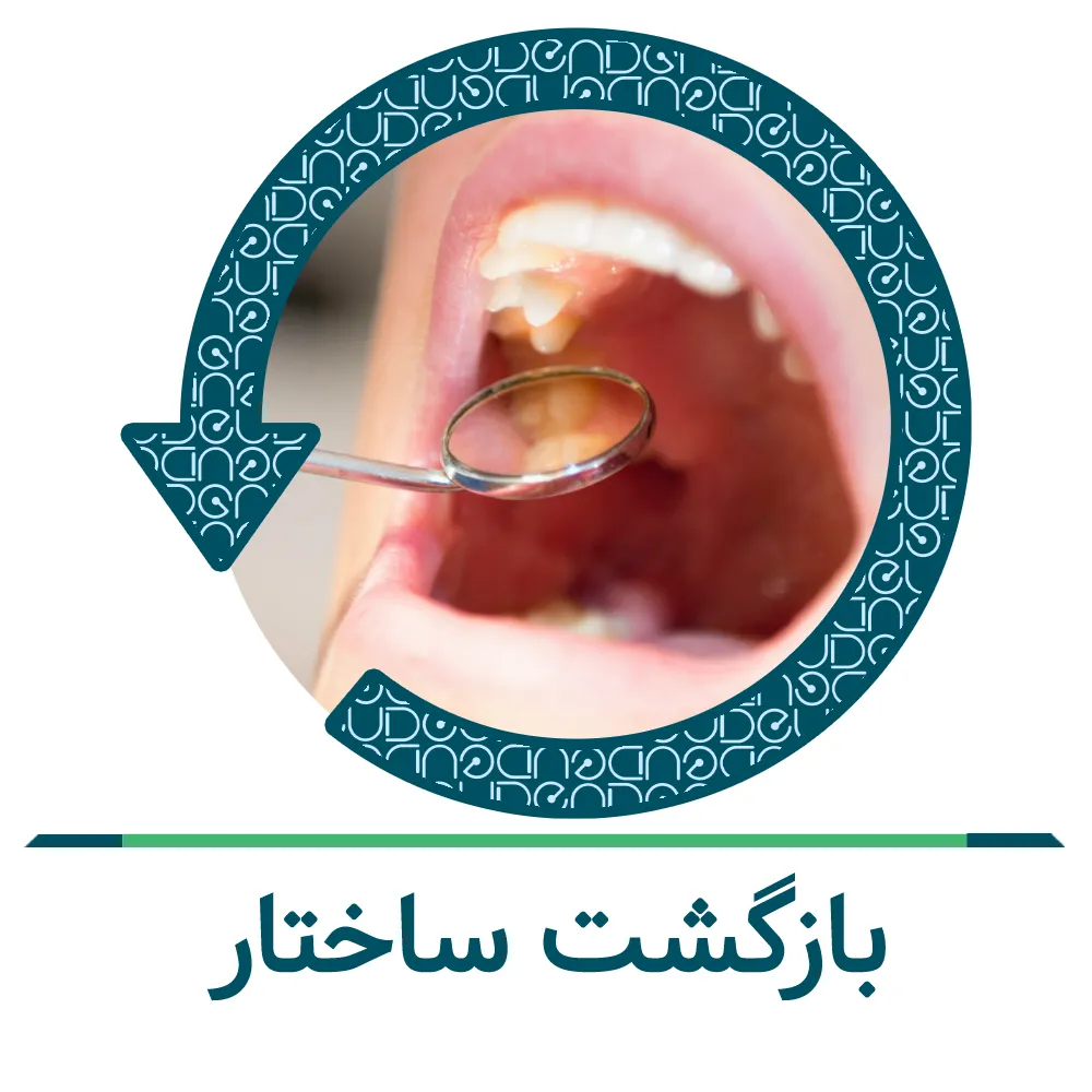 پر کردن دندان