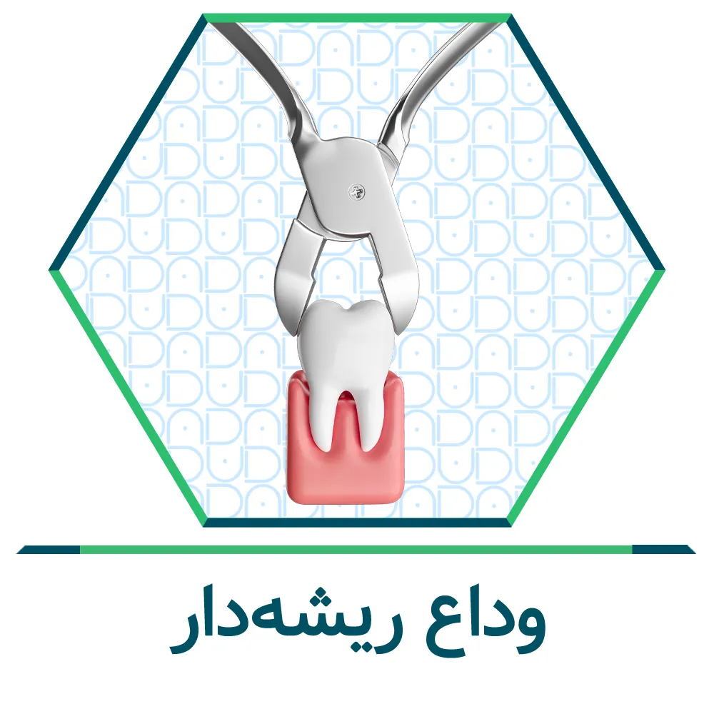 کشیدن دندان عقل