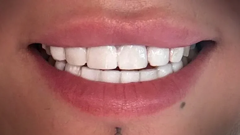 3-after