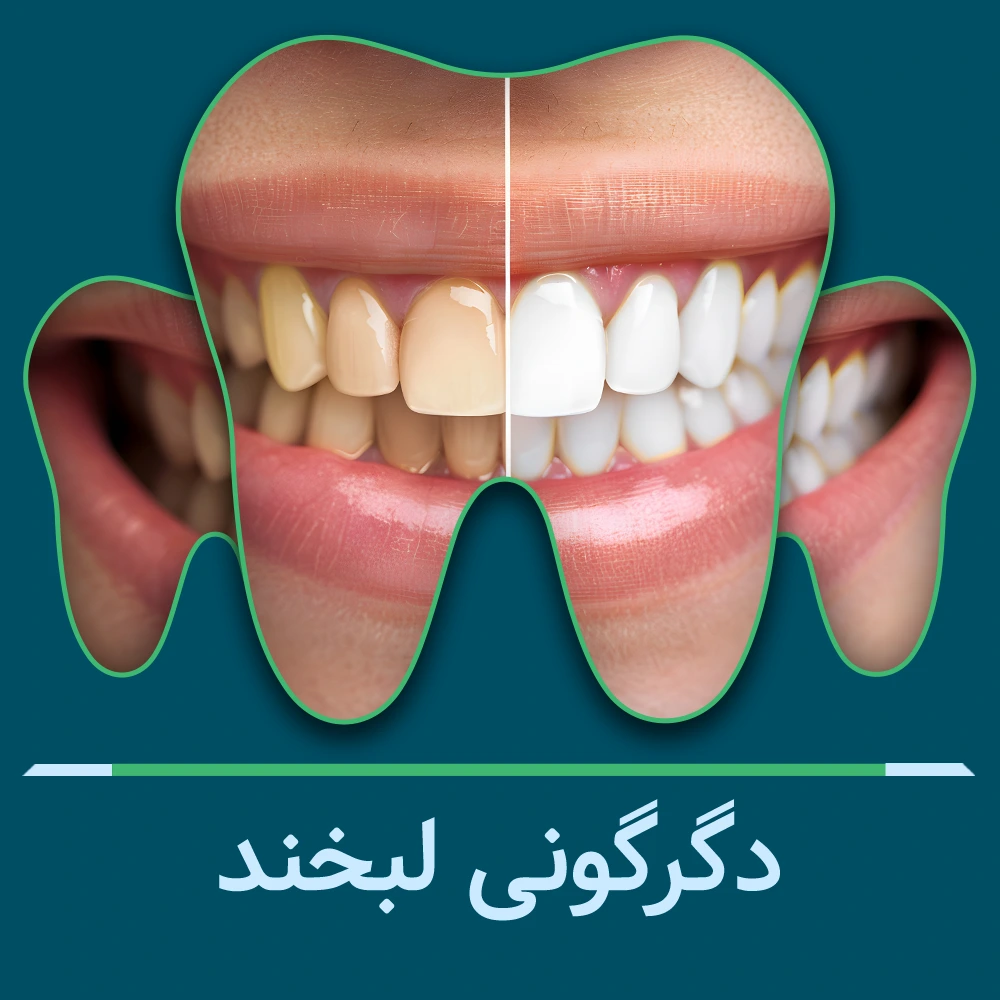 نمونه کار قبل و بعد دندانپزشکی
